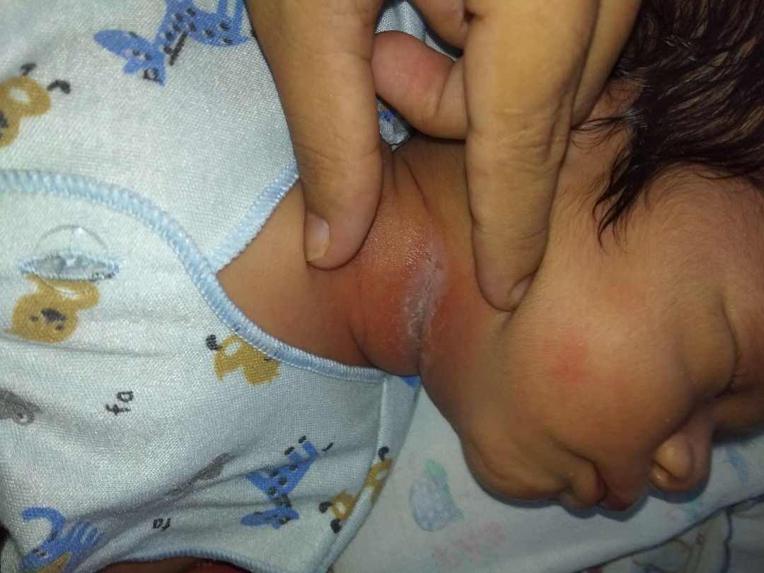 help mom,, baby q lehernya kog gini ya??