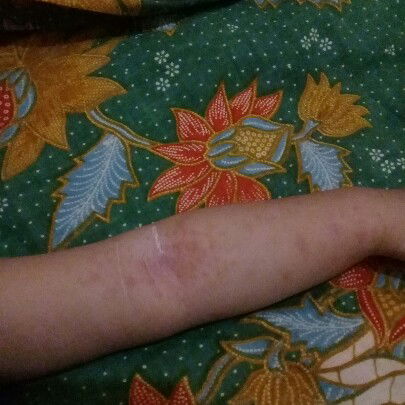 seputar kesehatan anak