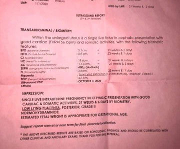 SINO PO DITO MAKA EXPLAIN SAKIN?