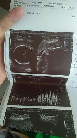 Baby Girl Name Suggest Po kayo :)😍😘