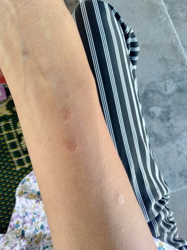 ใครเคยเป็นไหม?