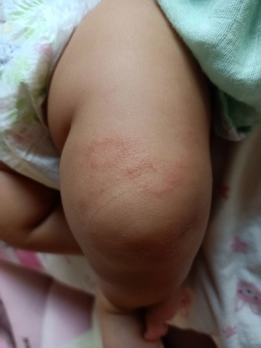 น้องเป็นอะไรเหรอคะ