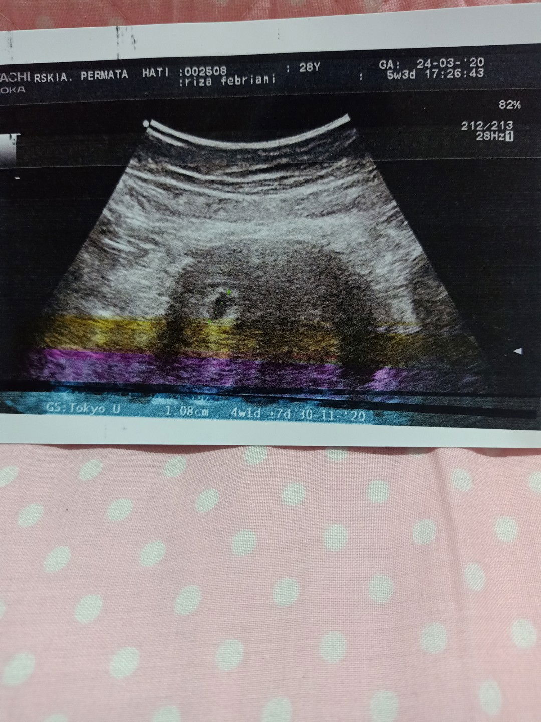 kepikiran vonis dokter