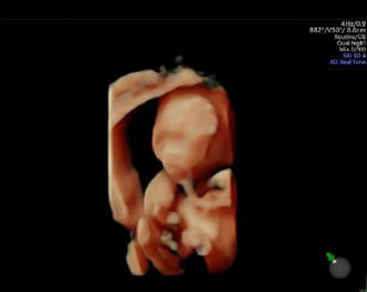 mom to be profile icon