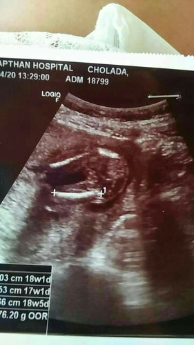 เพศลูก