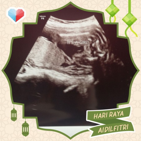 scan 23mnggu