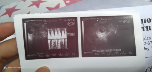 Babyphoto