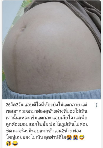 ทีมกย.ท้องใครเริ่มแตกลายบ้างแล้วคะ????