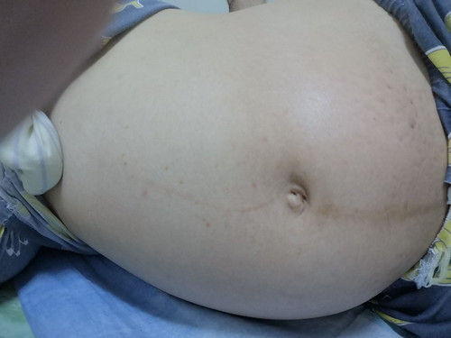 28วีค5วัน ท้องใหญ่มาก น้ำหนักเพิ่มมา10กิโลอัพ
