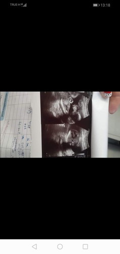 เด็กน้อย