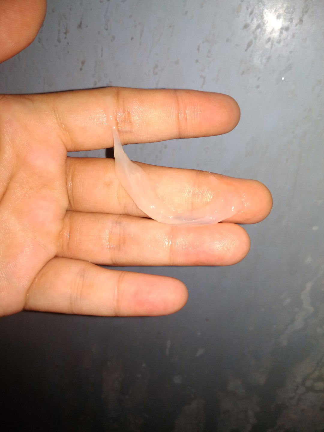 Lendir dari jalan lahir