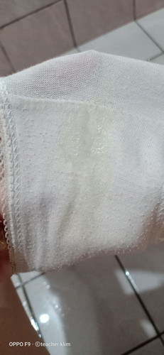 Vaginal Discharge