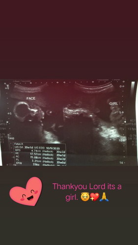 ultrasound result. ?