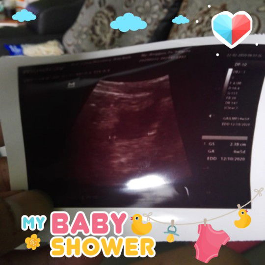 hamil 6 minggu baru terlihat kantung