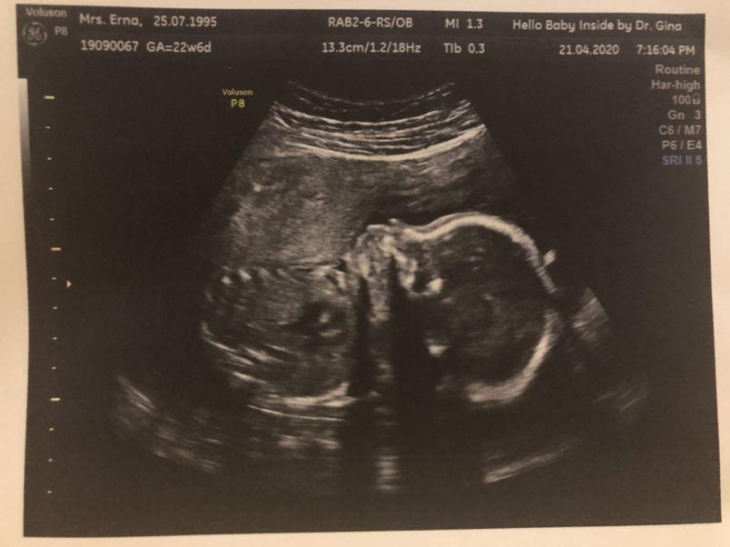 Erna Ang profile icon