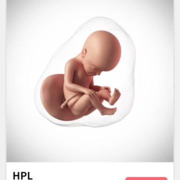 Ada Yg sama HPL meii??sharing Yuk,, apa aja Yg udah bunda rasain sekarang ?