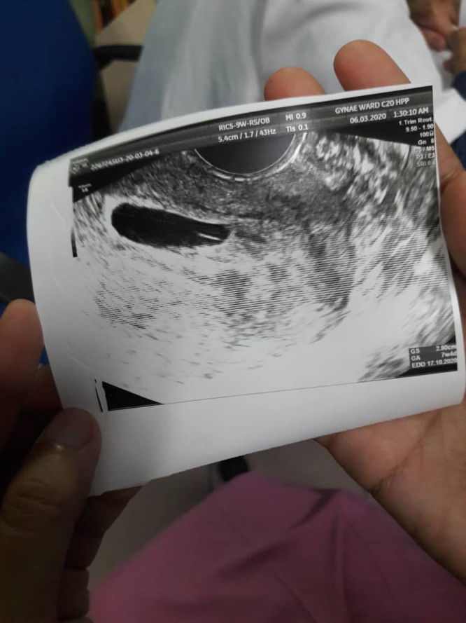 Hai mommies,semoga mommies semua sihat2 yer..