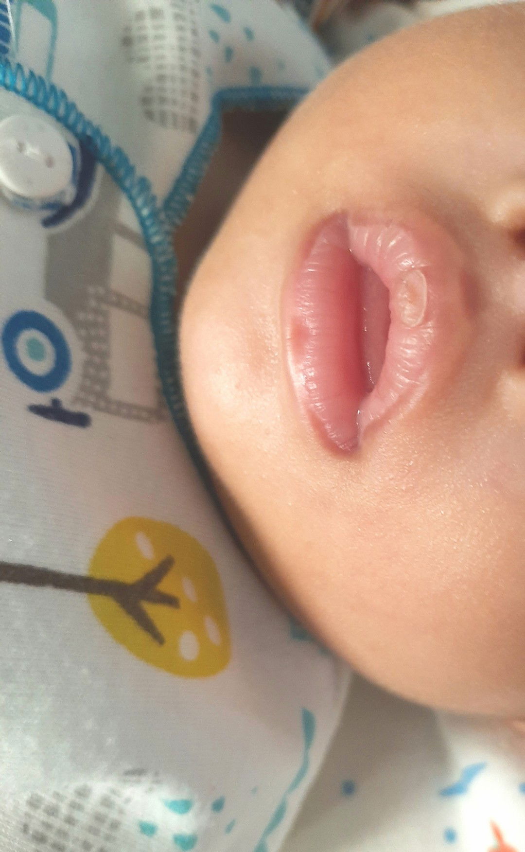 bibir kering pada bayi