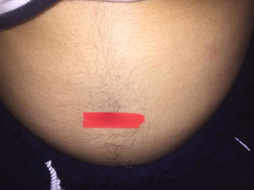 Week15