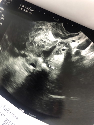 อิจฉาแม่ๆคนอื่นจังค่ะ