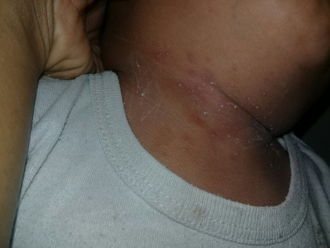 bruntusan