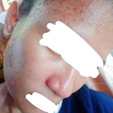 Skincare pls