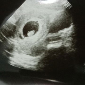 tebak2an aja biar ga gabut ? no bully ?