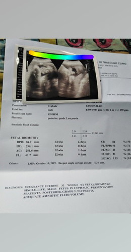 32 Weeks?