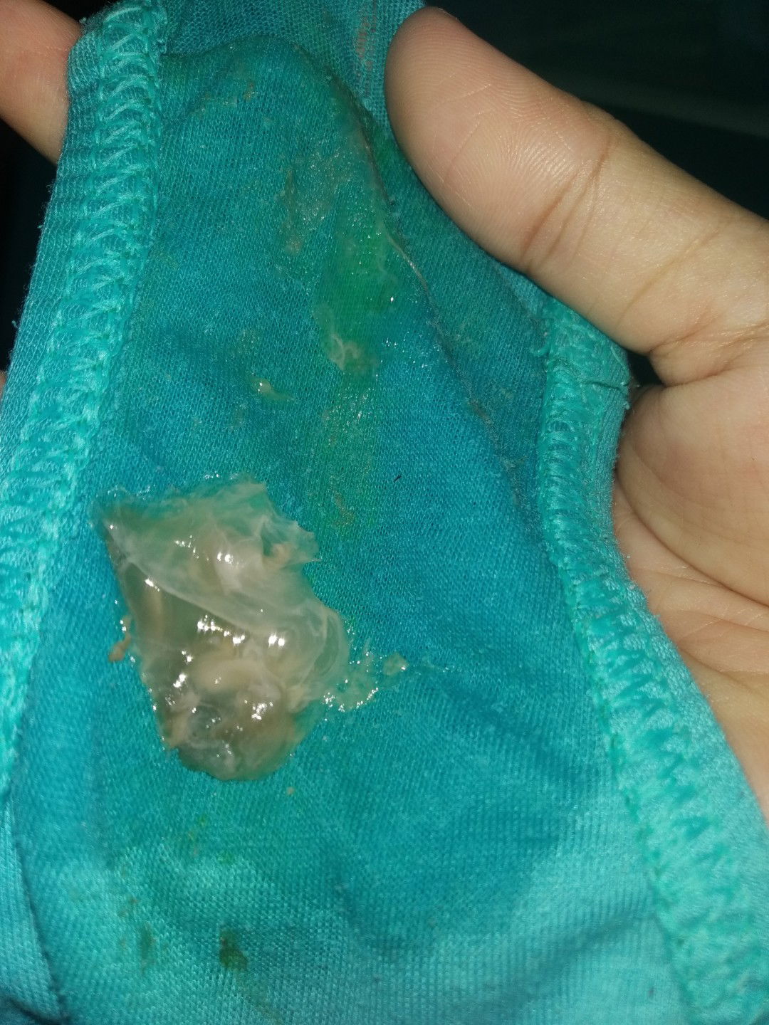 mucus plug po ba to?