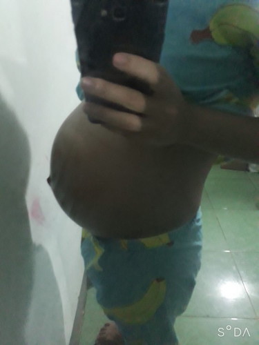 36w2d
