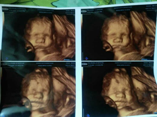 Bunbun rere profile icon