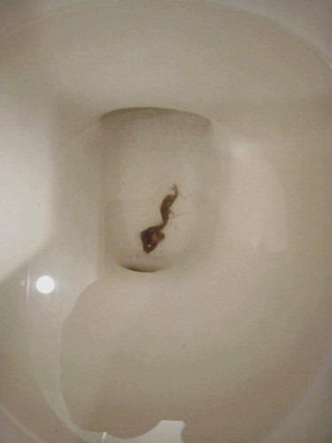 มีเลือดออก