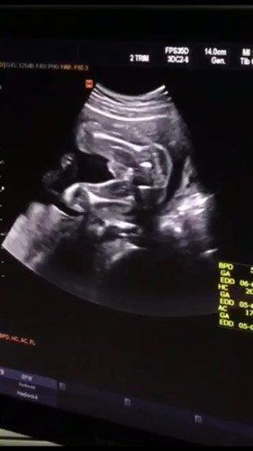 แบบนี้คือเพศชายชัวร์ๆเลยใช่ไหมคะ