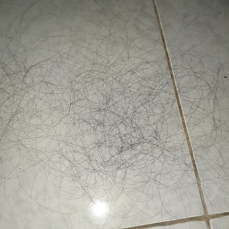 rambut rontok parah