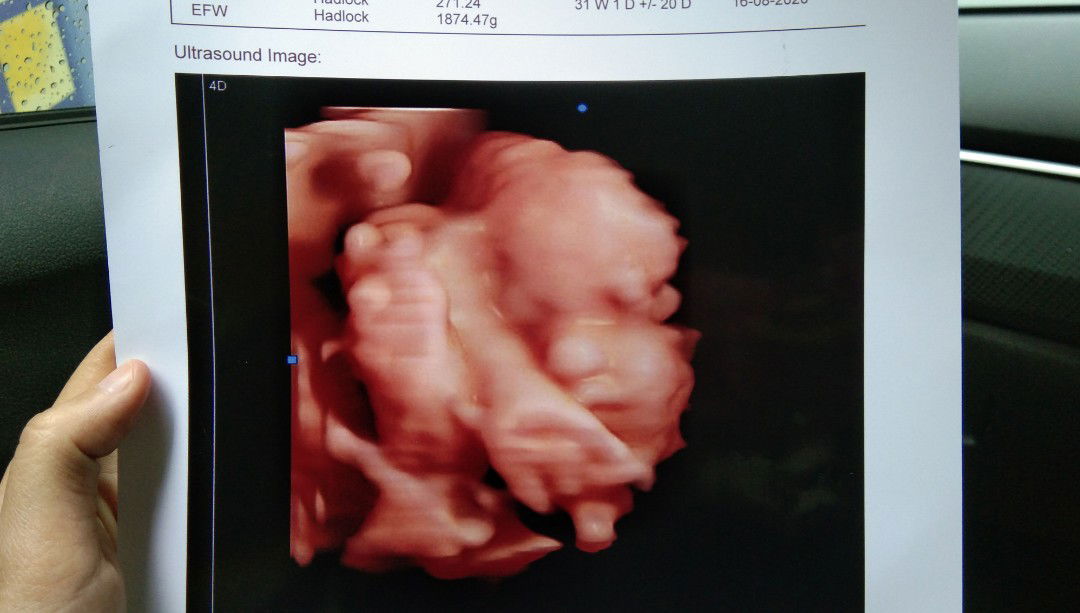 Siti Aisyah profile icon