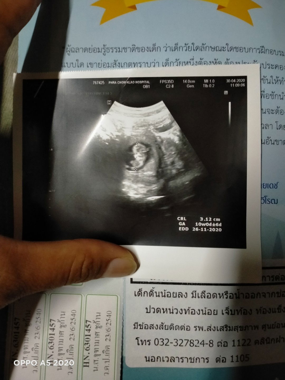 โชคดีน่ะที่ไม่เป็นอะไร