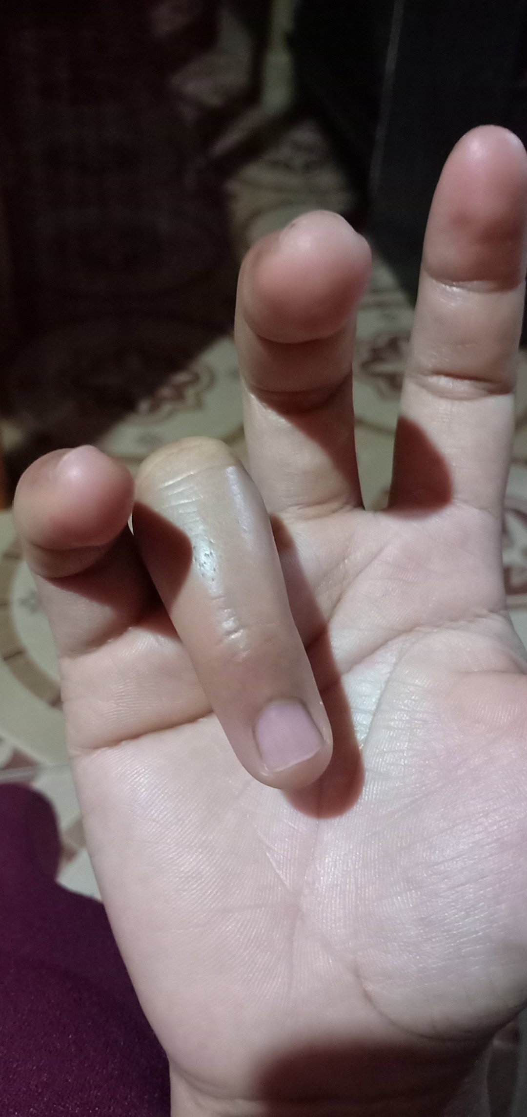 sering kesemutan