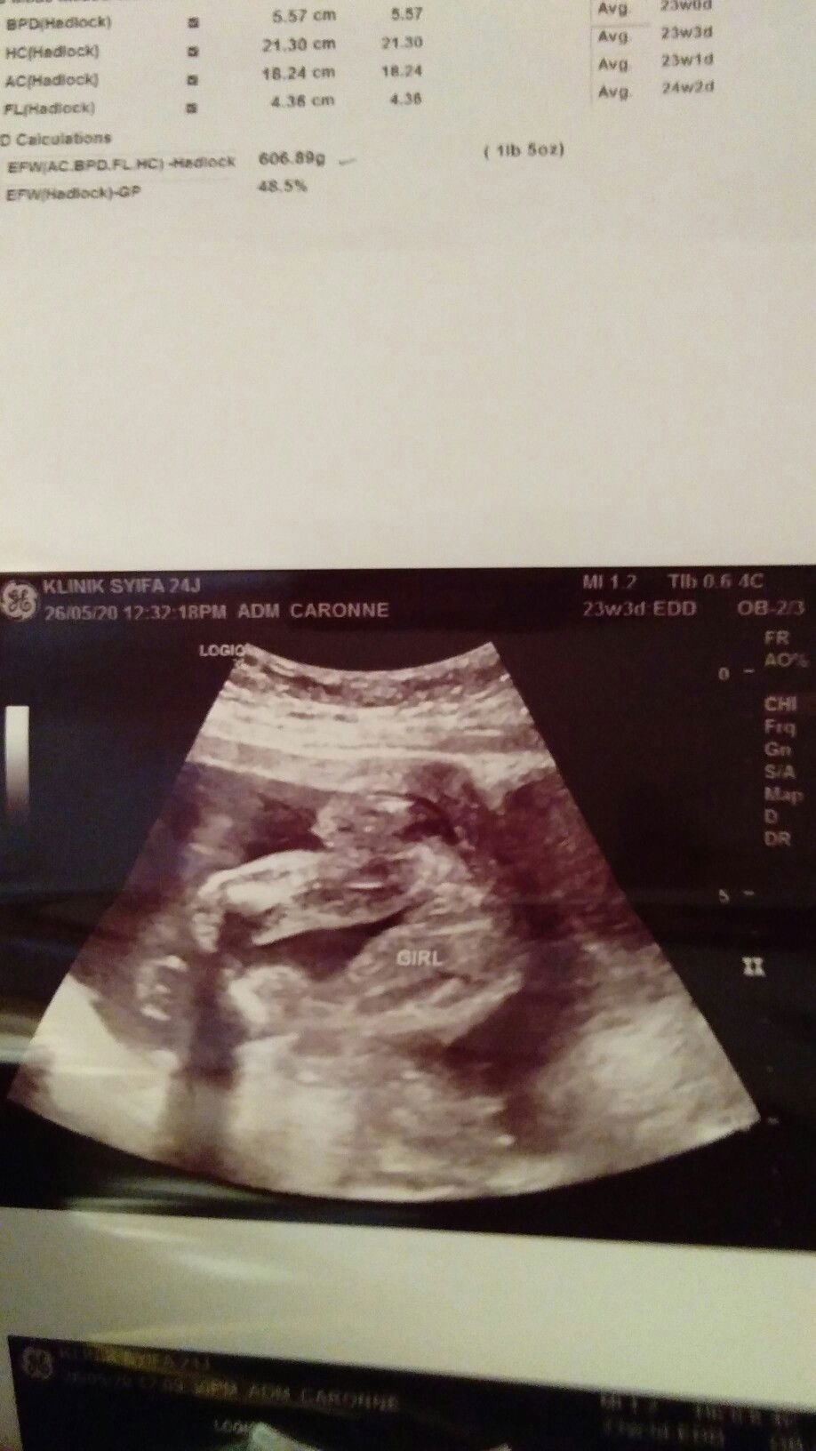 ni baby boy atau baby girl