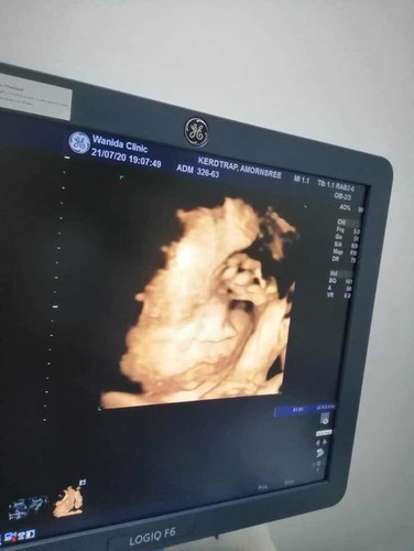 31W