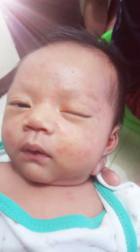 Baby's Skin Concern