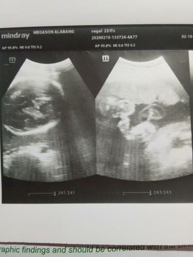 ask ko lang po anu po kaya gender baby ko 27 weeks napo