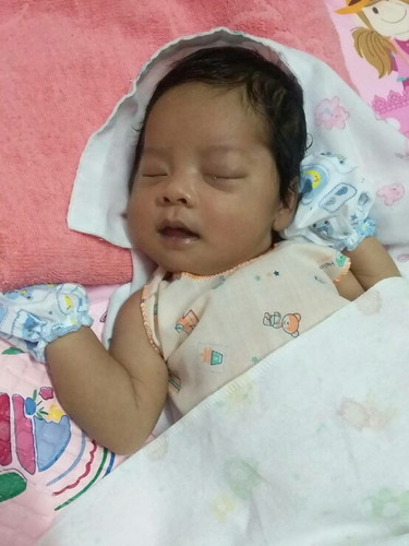 น้องมีอาการตาบวม