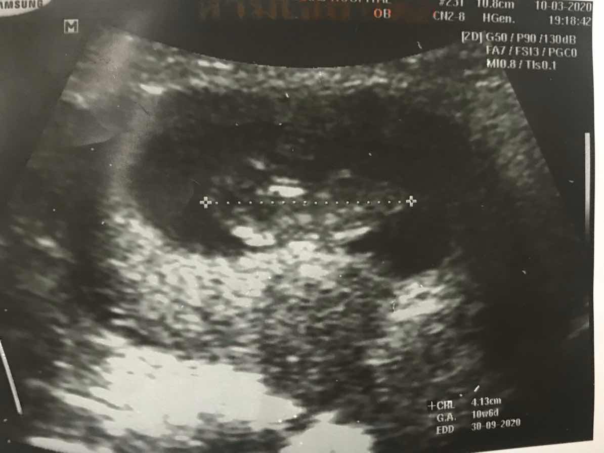 ปรึกษาหน่อยค่าา