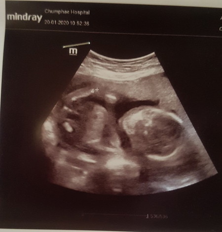 ใครพอดูเปนบ้างค่ะ หมอไม่ได้บอกเลยหญิงรึชายรูปตอนครรภ์ได้4เดือน