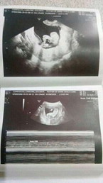 14 weeks ultrasound