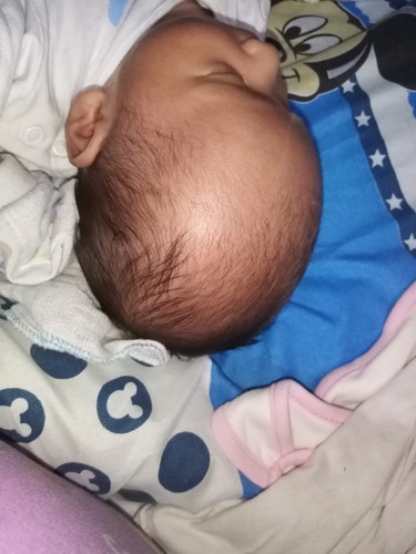 mga momsh , normal po ba size ng head ng baby ko , para kasi siyang pahaba. pa oblong. natatakot ako baka may hydrocephalus si baby. di ko oa siya nappaa check up kasi normal delivery ako at tagal ni baby lumabas nung pinanganak ko. sa lying in lang ako n
