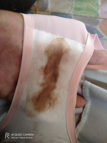 มีตกขาวสีน้ำตาลคล้ายเลือดก่อนเป็นประจำเดือน