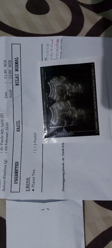 Positif Hamil, di USG belum keliatan Janin