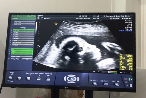 25 w บ้านไหนลูกกลับหัวแล้วบ้างคะ หรือ กลับหัวกันตอนกี่วีค