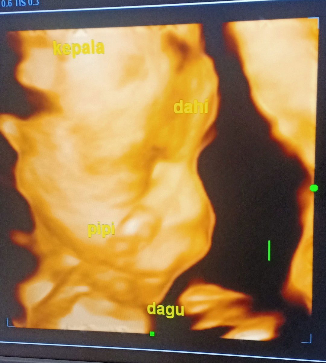 alhamdulillah 27weeks